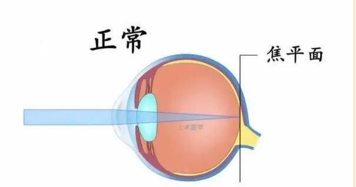 原来眼睛看不清有这么多原因?