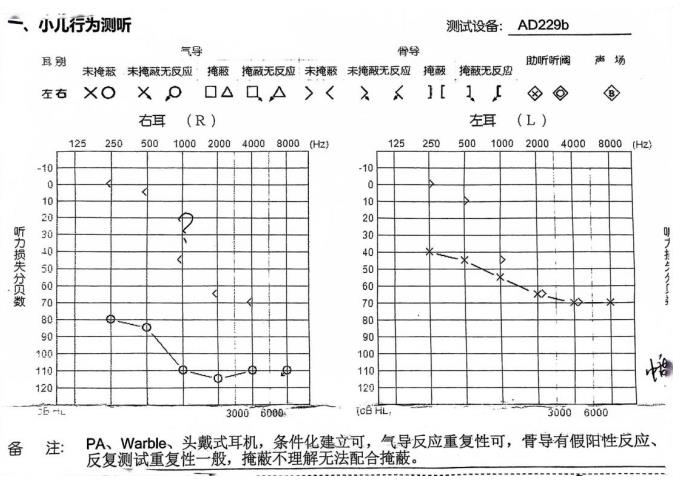 郑州助听器