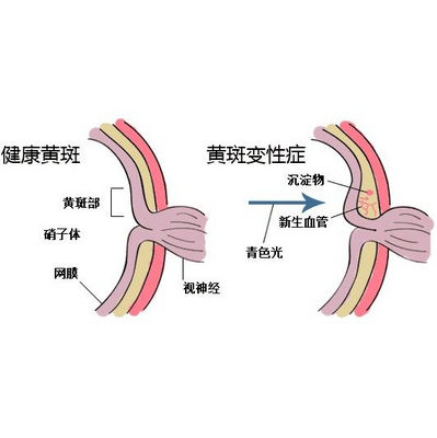 眼底病